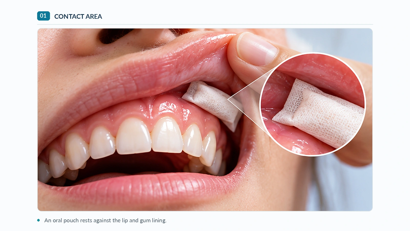 Nicopods contact area inside the mouth Nicopods and oral health: illustration showing a pouch resting against the upper gum and lip